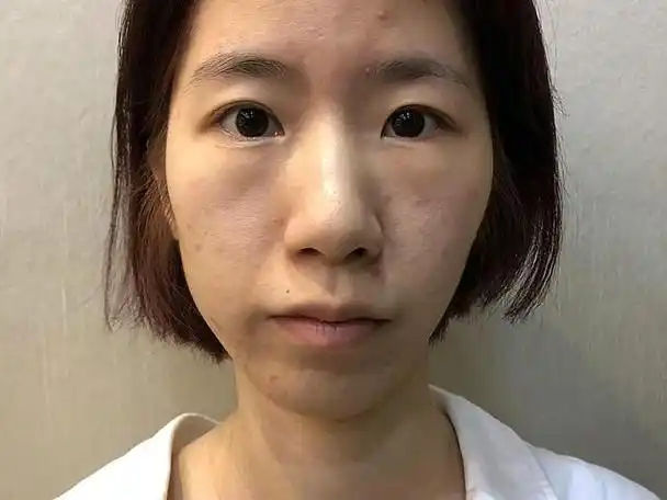 皮肤发黄暗淡的原因是什么,有哪些方法可以改善肌肤?