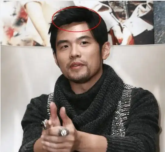 黄晓明上综艺被疑戴假发套,后脑勺稀疏头顶像帽子,小海绵或遗传_头发