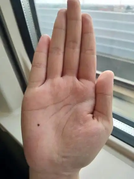 手掌上那颗痣代表什么?女生的右手,有没有会看手相的.