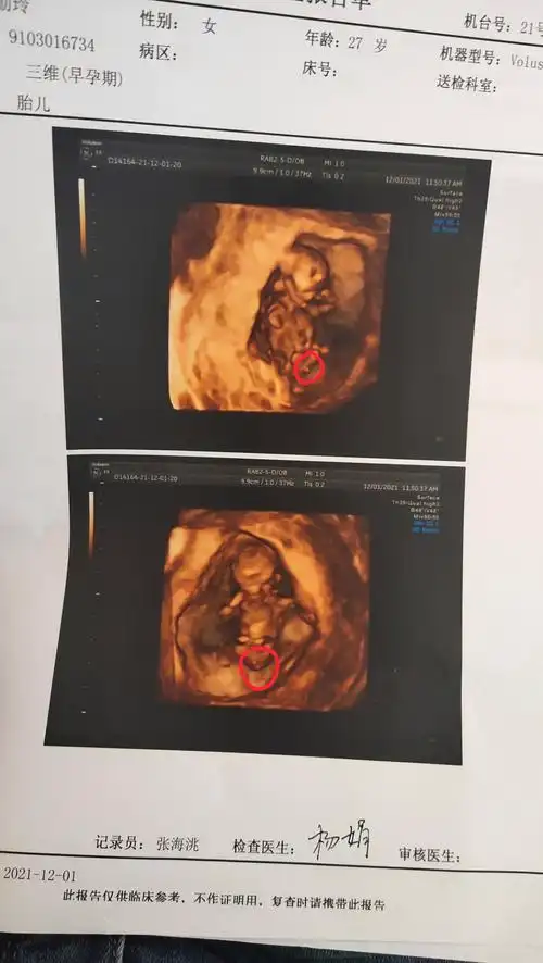 12月孕14周 5天宿州市妈妈网_mkpr5圈子同龄同城同院话题广场妈网态度