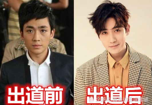 有种"整容"叫演员出道,邓伦赵丽颖逆袭,看到郑爽:幸好出道了