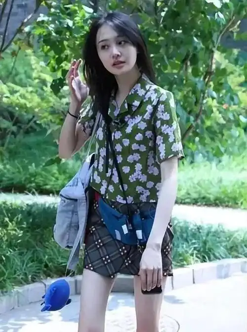 郑爽逃亡美国躲债近亿,近期生日照曝光,头发稀疏,身材瘦小干瘪|张恒