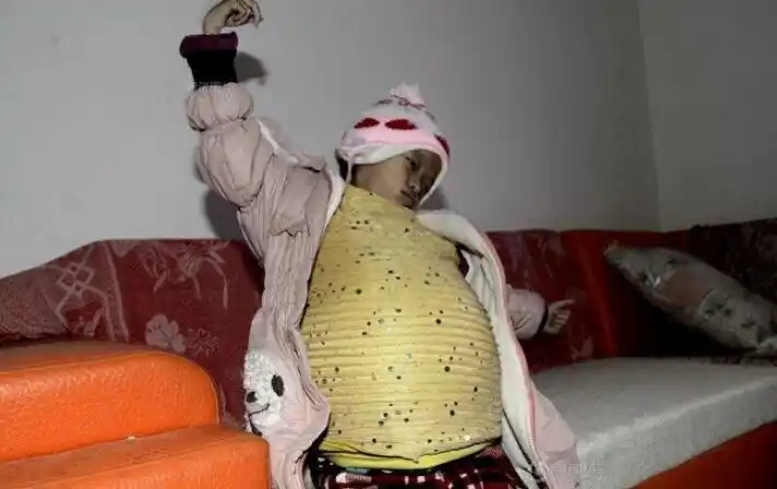 揪心农村12岁少女肚子大得如同怀胎10月贫困父母却无能为力