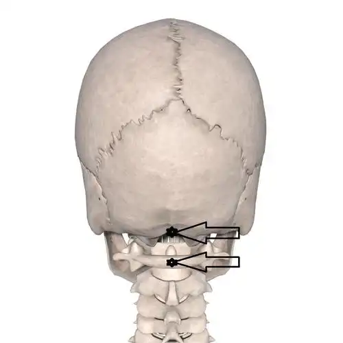 两手抱头,枕骨转向对侧,食指沿枕骨向下滑移并拉紧枕后皮肤,使寰枕