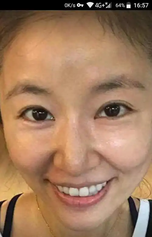 41岁林心如晒素颜照网友岁月痕迹依然美