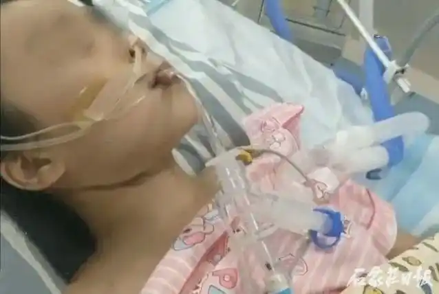 邯郸一10岁女孩"勒脖"窒息昏迷不醒,伤心妈妈公开求助