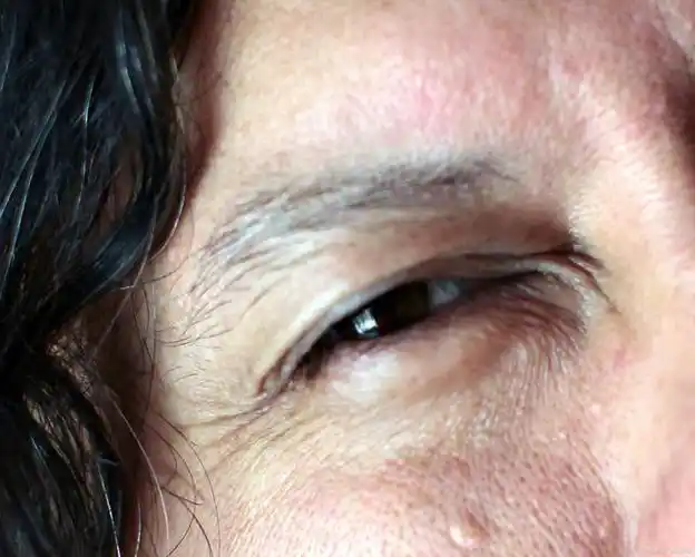 这是一个自然的过程,而在衰老过程中会出现脸上有皱纹,体力逐渐减弱