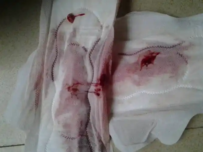 我真想问问我这是怎么了?来的月经怎么这样,肚子痛不是很力害.谢谢了.