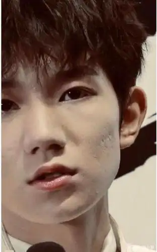 王源脸上狂长痘?皮肤状态极差,图片曝光美颜痕迹太明显!
