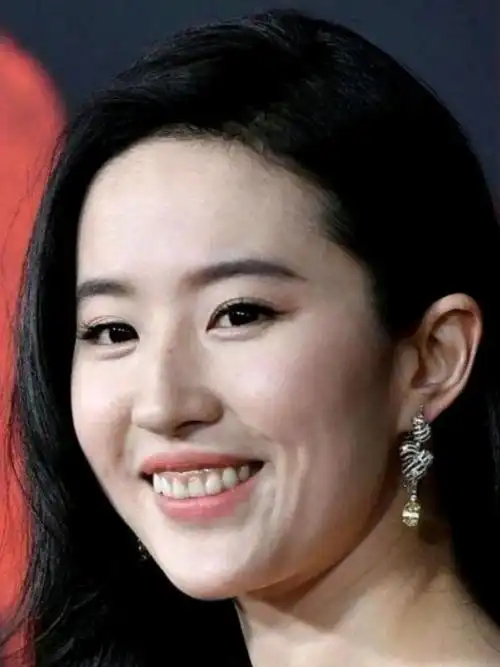 露龈笑怎么改善71