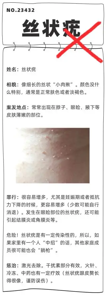 不要贴贴贴贴会传染得了皮肤疣一个传染俩