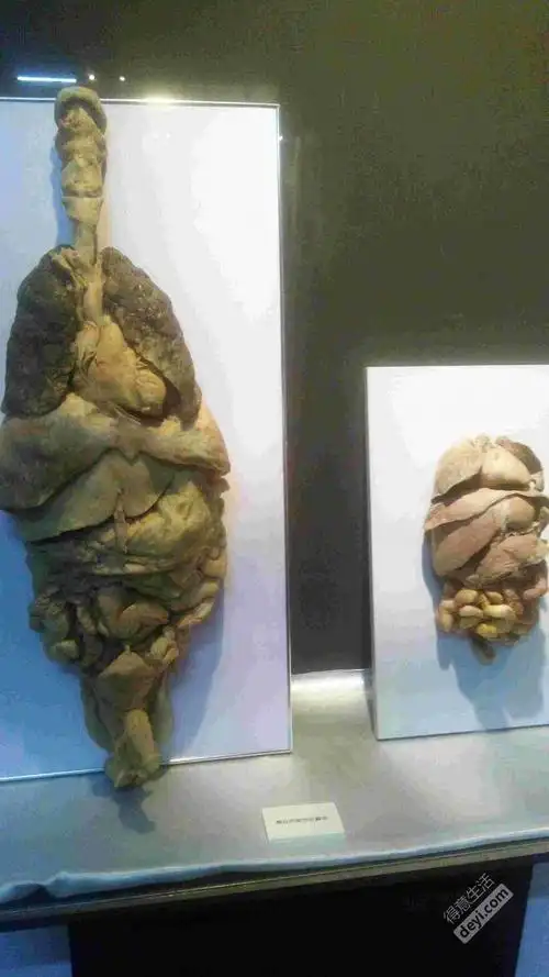 别人去汉阳造踏青,我看人体标本展!