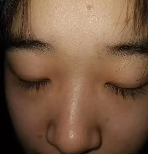 肤色暗沉发黄是为啥祛黄水乳推荐提亮肤色美白去黄一步到位