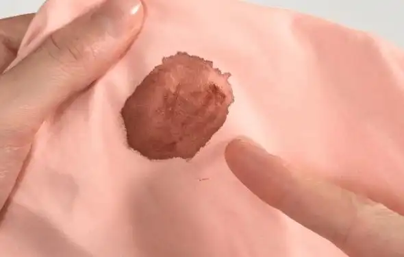 会引发一些炎症,这些炎症的病灶的分泌物不仅携带了大量的微生物,还有