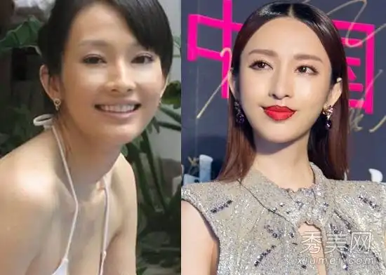 张俪旧照"土黑丑" 因整容与王阳明分手?