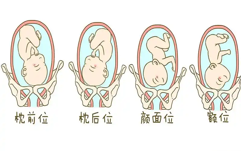 胎位不正的几种情况