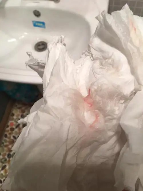 在白带中也会混有一yī些血xuè丝;您好,正常的白带