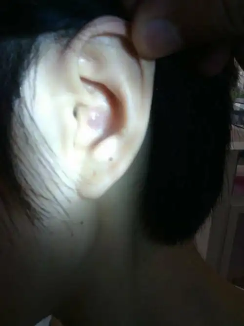 不知道怎么回事,去年是那只耳朵,现在是另外一个,这个包开始是肉色