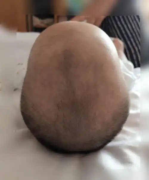 帮我看看宝宝是什么头型,该咋睡呢