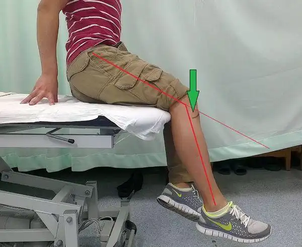 屈膝练习时,有部分患者会因为紧张或 造成错误动作,身体歪斜,臀部翘起