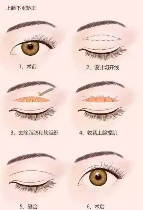 肖芃医生的眼睑日记