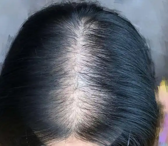 提醒:你可能并没有脱发,这5个真相你必须知道