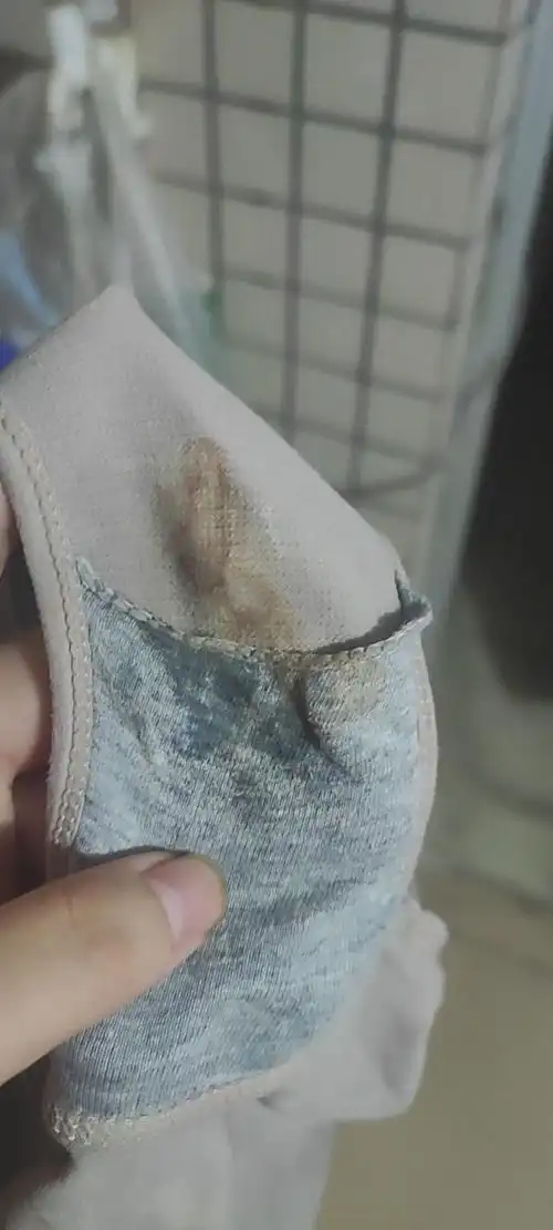 急,移植后第九天晚上洗澡时发现内裤上有不像血