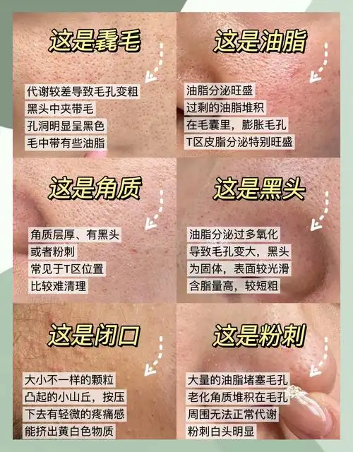 缩毛孔秘籍💖 毛孔粗大真的是个让人头疼的问题,特别是对于那些注重