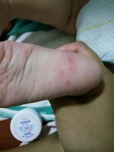 你可以帮我看一下宝宝脚底是怎么了