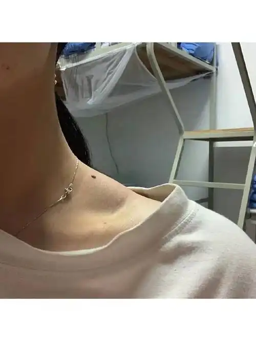 我之前的斜方肌超级发达,凸起来一大坨,超级明显的.