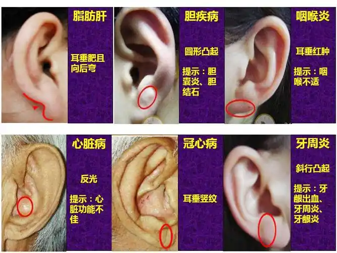 图说耳诊(作者:周远广) - zyg2