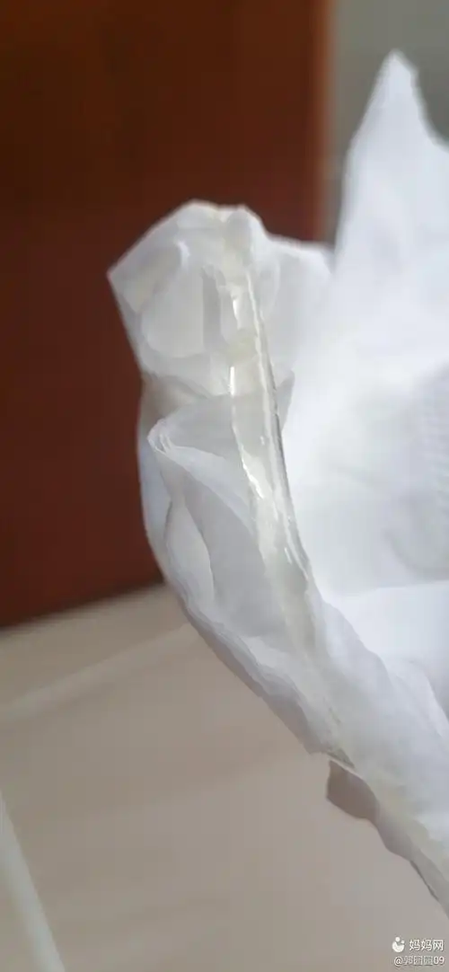 请问这是排卵期的吗,应该什么时候同房