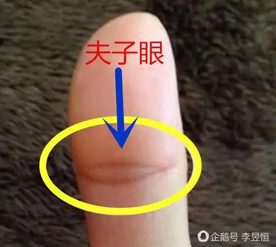 大拇指内侧第一节和第二节的关节处,是有两条或三条分开呈眼妆的纹路