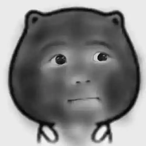 脸黑如果不是晒黑的那你可要注意了小心是这种病