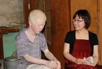 保险重疾白化病 白化病能买保险吗