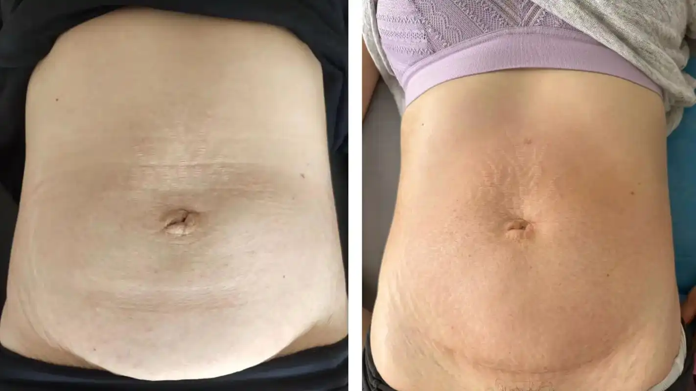 用最柔温的训方练式炼修成  内外紧瘦,内兼外修私的密修少炼女身材!