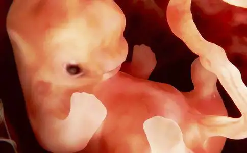 怀孕18周胎儿发育图