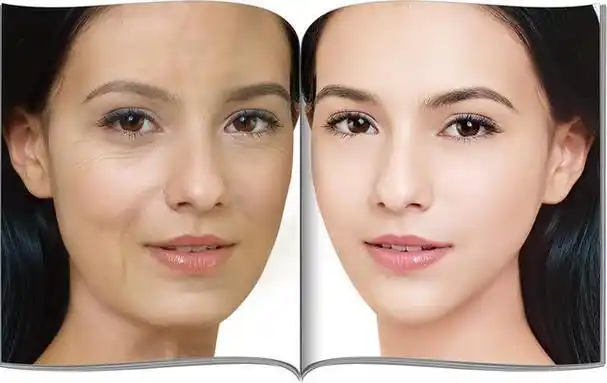 女性衰老5个因素,避免它们,远离"大妈感",或可保持年轻健康