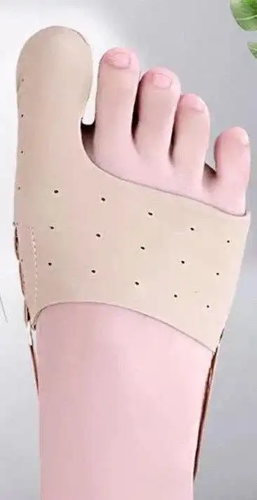 拇外翻的保守治疗