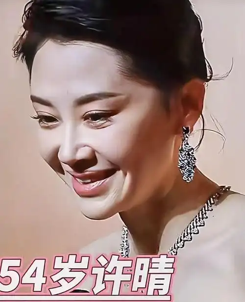 54岁许晴活动生图曝光!皮肤白皙满脸皱纹似大妈,脸部僵硬似假人
