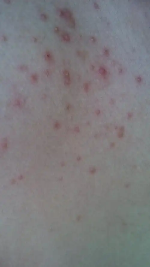 不痛不痒,请问,我这是什么皮肤病?跪谢医生解答!