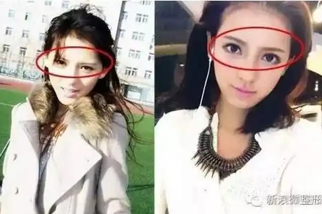 张予曦离开王思聪,靠一张混血脸从网红升级成了网剧女主