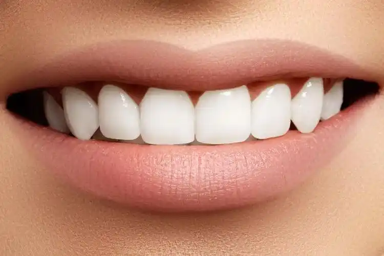 微笑后的洁白健康的牙齿