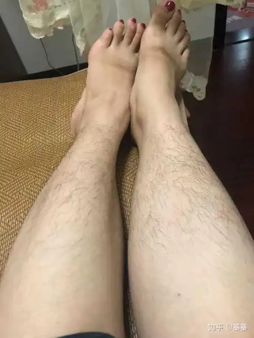 女孩子长腿毛怎么办?