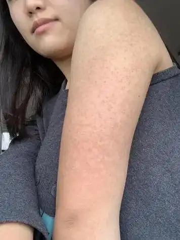 女性拥有光滑细腻的皮肤是主带福气的,然而,若是皮肤变得粗糙,情况便