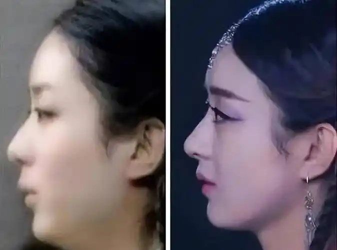 赵丽颖整容?11年前综艺旧照被找出,和现在对比,变化一目了然