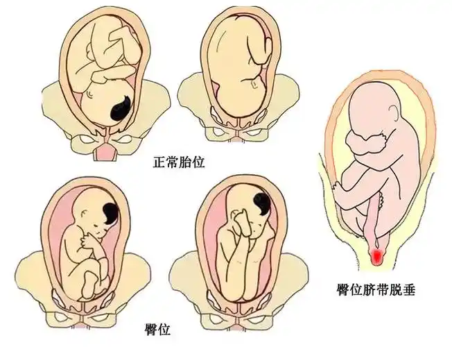 (附11月孕妇,家长学校课程表)|分娩|妊娠|医生|胎儿畸形_网易订阅