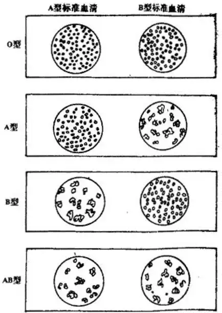 判定血型可根据下图示内容