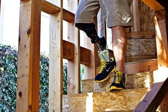 高科技仿生假肢可以让运动选手更快更强