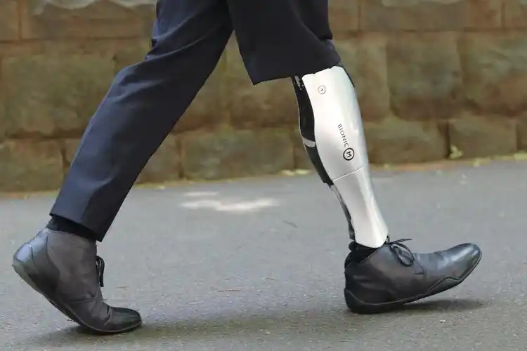 选择假肢的需要注意哪些事项?